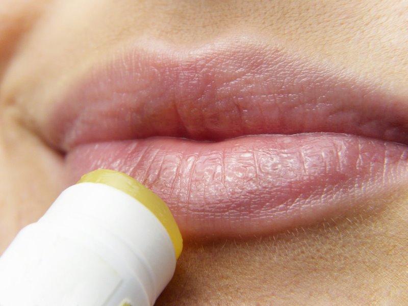 Lippenbalsam wird auf spröder Lippe aufgetragen