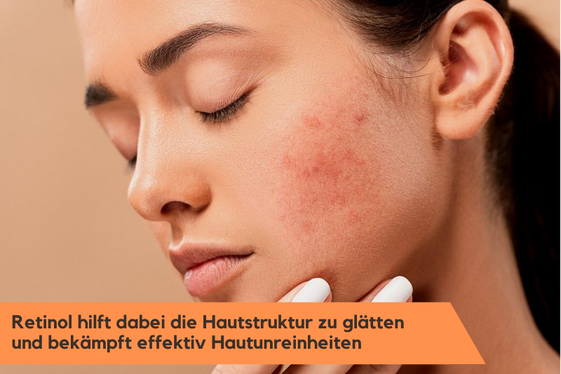 Retinol bekämpft effektiv Hautunreinheiten