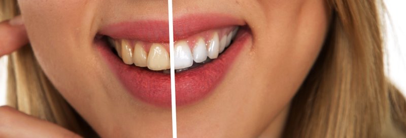 Whitening-Zahncreme